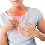 Acid reflux symptoms
