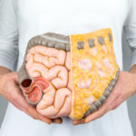 symptoms of bowel cancer